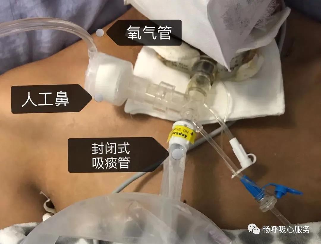 1583390593744732.jpg 微信圖片_20200305144625.jpg